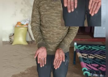 अब आंख पर पट्टी बांधकर फतेहपुर सीकरी पुलिस ने दी युवक को थर्ड डिग्री
