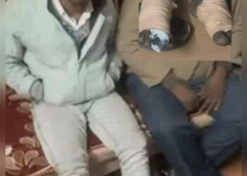 पुलिस की थर्ड डिग्री से नरेंद्र के दोनों पैर सूजे, बंधी पट्टी, बोला- पुलिस वालों ने जख्मों पर मिर्च भी झोंकी थी