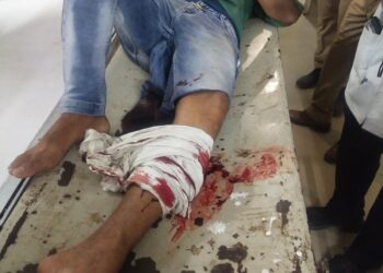 11 साल से फरार चल रहे बदमाश से पुलिस की मुठभेड़