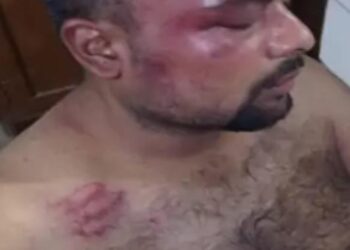 हरीपर्वत में बजरंग दल नेता पर चाकू से हमला