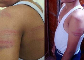 यूनीफॉर्म नहीं पहनने पर शिक्षक ने छात्र को डंडे से पीटा