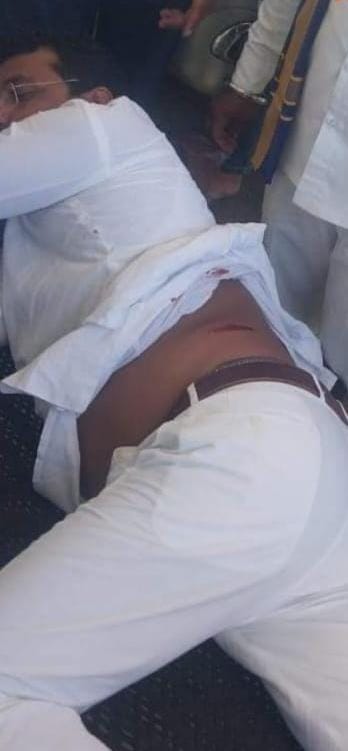 भीम आर्मी प्रमुख चंद्रशेखर पर जानलेवा हमला, कमर में लगी गोली