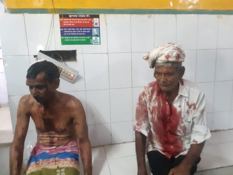 बच्चों के विवाद में चले लाठी फरसे तीन घायल, एक गम्भीर