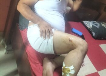 चंबल नदी में पितृ तर्पण के दौरान मगरमच्छ के हमले से दो युवक घायल