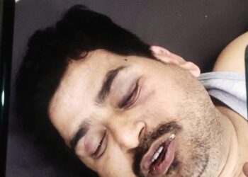 आगरा के हेड कॉन्स्टेबल को इटावा पुलिस ने दी थर्ड डिग्री, हालत गंभीर