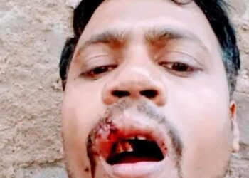 झगड़े की दो घटनाओं में तीन लोग घायल