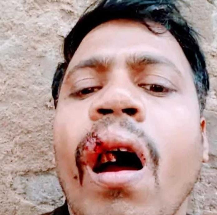 झगड़े की दो घटनाओं में तीन लोग घायल