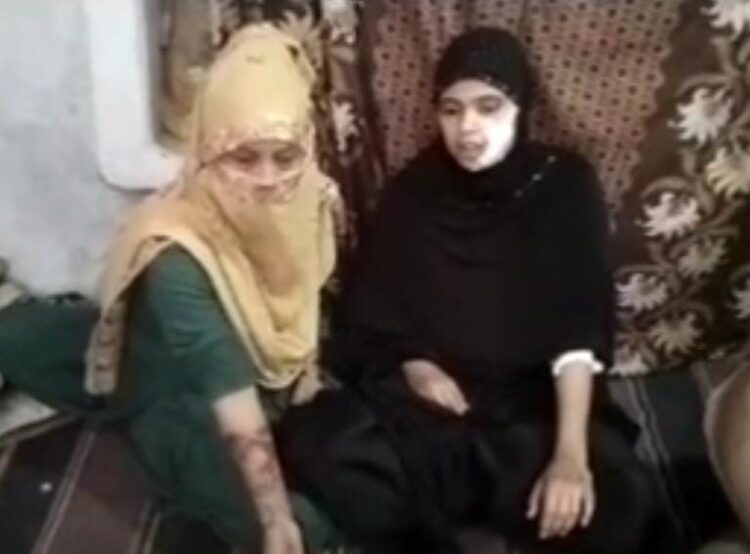 शाहगंज में युवती पर फेंका तेजाब, पुलिस ने एनसीआर दर्ज कर की खानापूर्ति