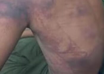 मलपुरा में बहन से छेड़खानी का विरोध करने पर दबंगों ने चार घंटे तक नाबालिग को बंधक बनाकर पीटा