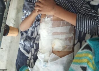 बच्चे का एक्सीडेंट करने वाले आरोपियों पर कार्रवाई नहीं कर रही पुलिस, पीड़ित बोले एकता चौकी पर जाकर करेंगे आत्महत्या