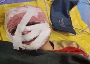 भाभी ने ननद को सरप्राइज गिफ्ट देने के बहाने आंख और हाथ बांधकर चाकू-तवा-चिमटा से बोला हमला