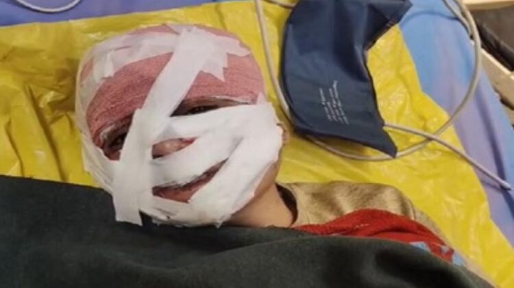 भाभी ने ननद को सरप्राइज गिफ्ट देने के बहाने आंख और हाथ बांधकर चाकू-तवा-चिमटा से बोला हमला