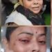 ना चोरी खुली ना महिला से मारपीट और छेड़छाड़ के मामले में पांच महीने में जांच पूरी हुई, सीएम आवास पर आत्मदाह करने पहुंची महिला