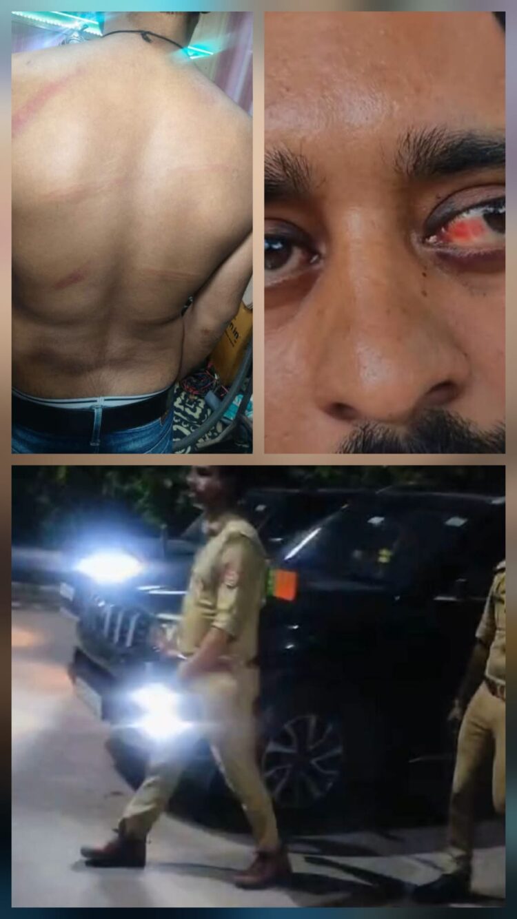 नेता के इशारे पर ताजगंज थाना पुलिस पर पीटने के आरोप